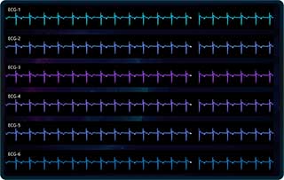 Sweeping Line Chart