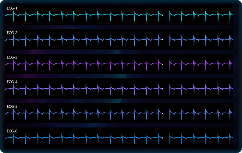 Sweeping Line Chart