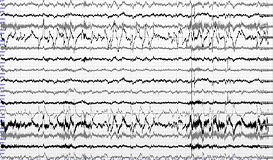 EEG .NET chart
